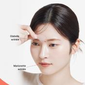 ACROPASS Reti-Rn Microcone Patch T-Shape - plasturi formulati cu retinol si PDRN, care contribuie la ingrijirea ridurilor si la imbunatatirea fermitatii pielii - 4 buc