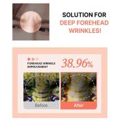 ACROPASS Reti-Rn Microcone Patch T-Shape - plasturi formulati cu retinol si PDRN, care contribuie la ingrijirea ridurilor si la imbunatatirea fermitatii pielii - 4 buc