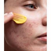 ALLIES OF SKIN Retinal 0.1% and Peptides Advances Repair Night Cream, 20 ml - crema de fata formulata cu retinal 0.1% si complex de peptide, care contribuie la imbunatatirea vizibila a texturii pielii si a semnelor de imbatranire si la metinerea confortului cutanat