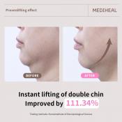 MEDIHEAL Retinol Collagen Ampoule Lifting Sheet Mask - masca de fata tip servetel formulata cu retinol si colagen, care contribuie la hidratarea pielii si la imbunatatirea aspectului ridurilor - 30 ml
