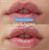 BELIF Super Knights Mint plumper Lipcerin balsam de buze - hidratare si volum, 15 ml