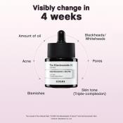The Niacinamide 15 Serum Ser de fata 20 ml
