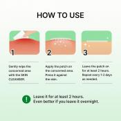 Trouble Care Microcone Patch Small Plasturi cu micro-ace 9 buc