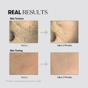 VT COSMETICS TX-Toning Essence 1000 Shot Esenta - luminozitate si hidratare, 30 ml