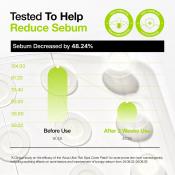 Ultra-Thin Spot Cover Patch Plasturi pentru acnee 75 buc