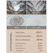 VILLAGE 11 FACTORY Vegan Deep Clean Scalp Shampoo Sampon - curatare si hidratare, 300 gr