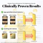 MADECA DERMA Vita Brightening Ampoule ser de fata - luminozitate si hidratare, 7 ml x 5 buc