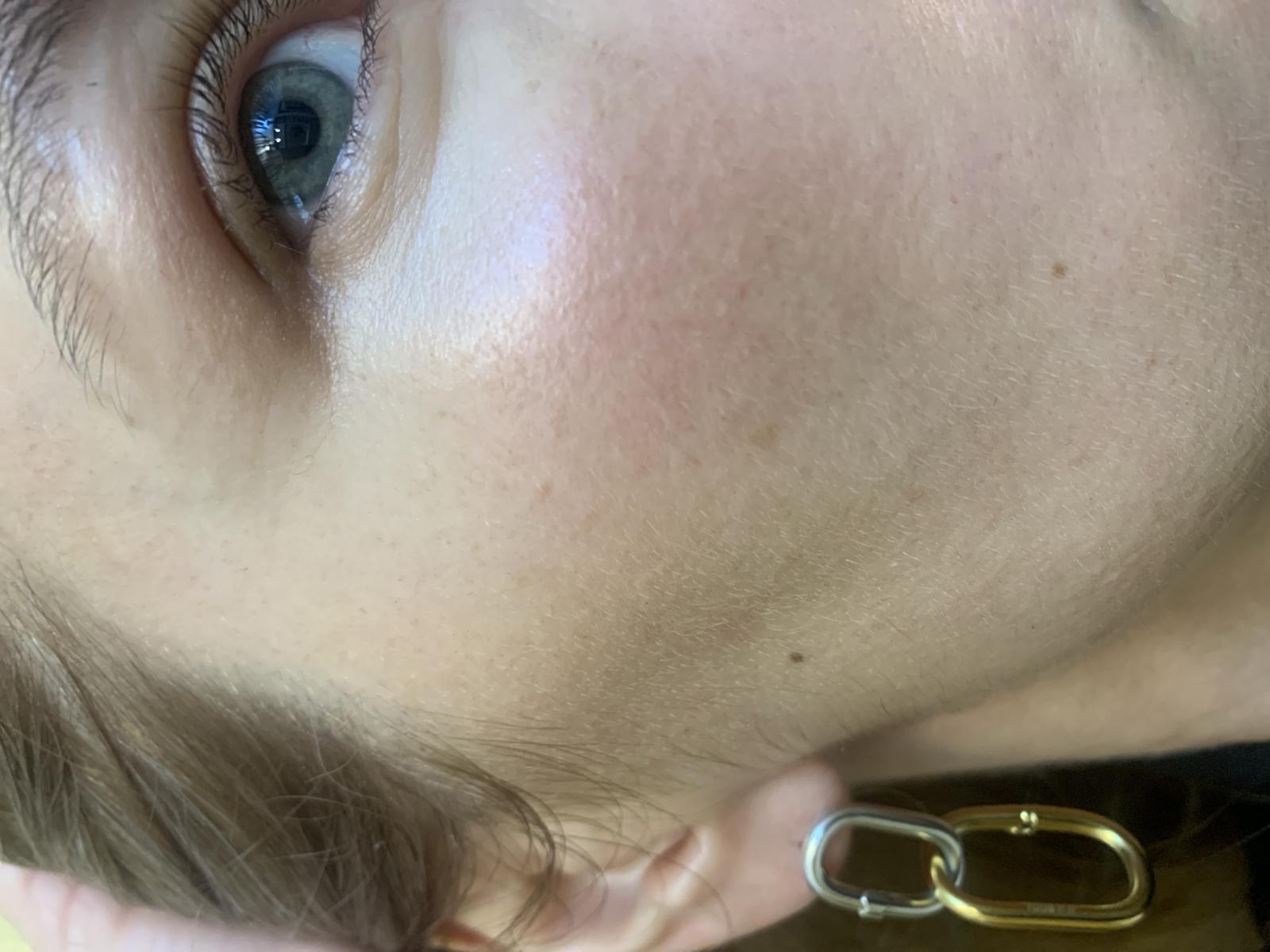 VT COSMETICS 300 Reedle Shot Ser de fata 2ml x 10 buc